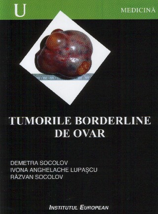 Tumorile borderline de ovar de Demetra Socolov